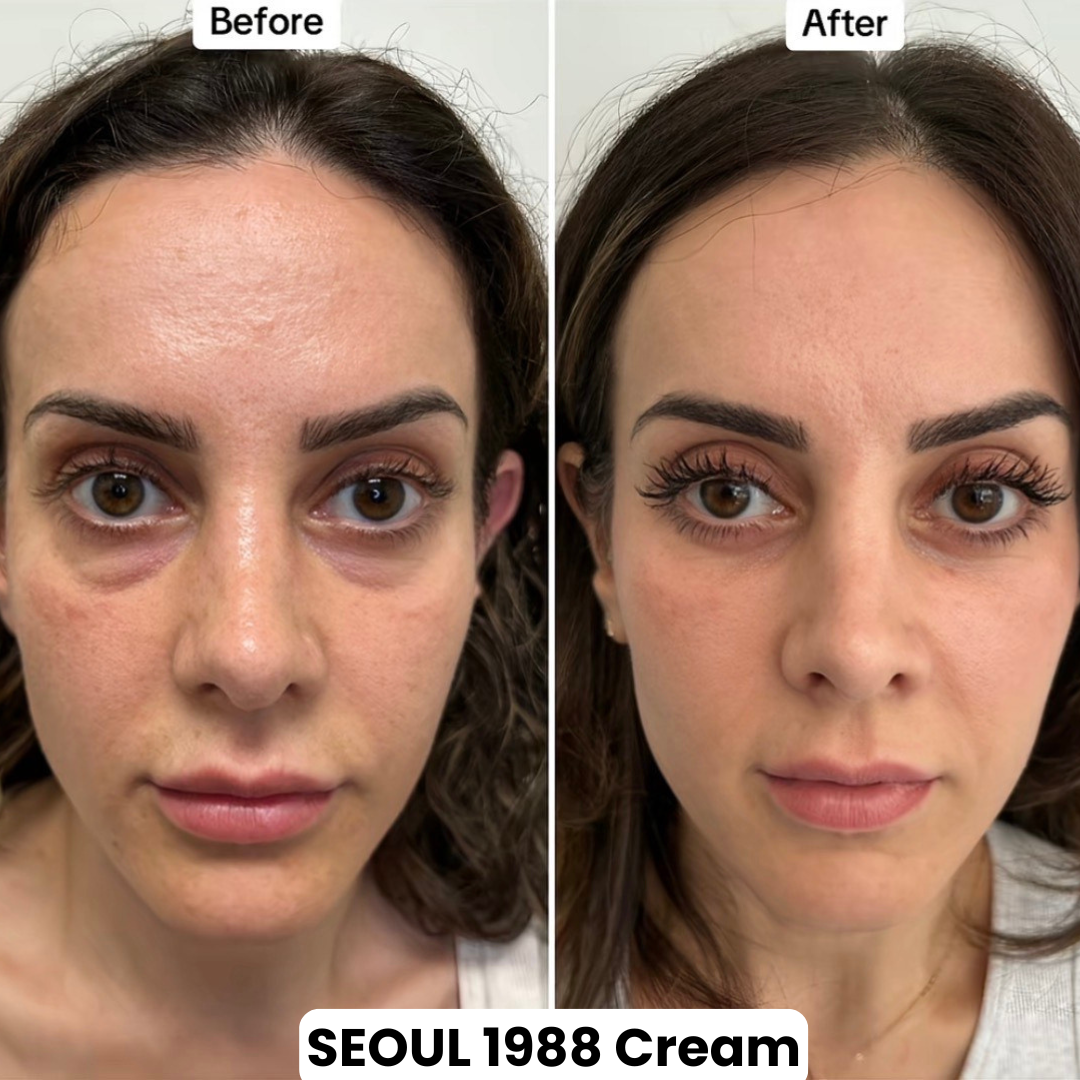 Seoul 1988 Eye Contour Cream