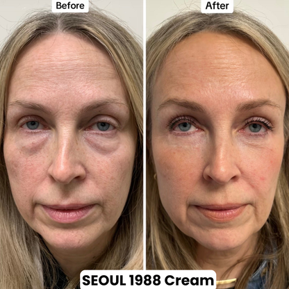 Seoul 1988 Eye Contour Cream